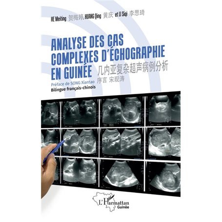 Analyse des cas complexes d'échographie en Guinée