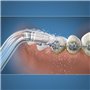 Embout Hydropulseur - WATERPIK - Orthodontique - Élimine la plaque - Spécial appareils dentaires