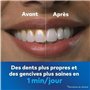 Waterpik WF-20 Pulse, Hydropulseur Sans Fil, Recommandé par l'UFSBD, Jet dentaire Rechargeable, Elimine la Plaque, Blanc