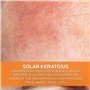 La Roche-Posay ANTHELIOS 100 KA+ MED 50 ML, Blanc, orange, 50 ml (Confezione da 1)