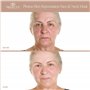 Masque de Luminothérapie 7 couleurs par Project E Beauty | Soins du Visage | Eclaircit et Raffermit la Peau | Calme l'Inflammati