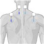 GLOBUS | Genesy 300 Pro, électrostimulateur à 4 canaux, 91 programmes pour la physiothérapie