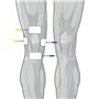 Globus | Genesy S2, électrostimulateur à 2 canaux, 60 programmes pour la physiothérapie