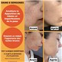60 ml. BIO Sérum Visage à la Vitamine C/E, Acide Hyaluronique Pur et Niacinamide – Anti-rides, Anti-taches, Anti-âge et Hydratan