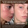 Appareil Radiofréquence Lifting Visage, Ibtyzo Appareil Visage Lifting EMS Appareil Anti Rides Visage 6 en 1 RF Masseur Visage R
