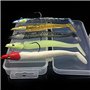 ANCLLO Appâts de pêche Souples avec hameçon à tête de Plomb, leurres de pêche en mer à la rhubarbe crème avec boîte (Lot de 5)