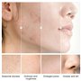 Fengyang® 5Pcs Set de Soins, Sakura Ensemble De Soins De La Peau, Soins Du Visage À Texture Rafraîchissante, Kit de Soins de La 