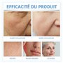 Réduction des