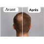 MEILLEUR SERUM BIO ANTI CHUTE CHEVEUX & POUSSE ACTIVATEUR INTENSE DE CROISSANCE 100%ROMARIN BIO; prévient et stoppe la chute des