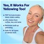 MySweetSmile Bandes Blanchissantes Dents PAP - Sans Danger pour l'Émail, Sans Sensibilité - Sans Peroxyde - Approuvées par les D