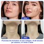 Ibtyzo 40K Masseur Anti Cellulite Appareil Minceur, 4 en 1 Lipocavitation Radiofréquence Visage et Corps Entier Masseur Aminciss