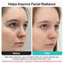 Aspirateur Point Noir Visage, Lrbsule Tire Comedon Point Noir Extracteur Nettoyant de Pores Blackhead Remover Aspirateur Point B