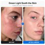 Profey Masque Led en 7 Couleurs,Masque Visage LED Effets Rajeunissants, Anti-Âge et Anti-Rides, Rechargeable et Portable Masque 