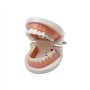 Youya - Modèle de dents de caries dentaires standard - Outil d'étude pour les maladies des adultes - Modèle standard - Pour appr