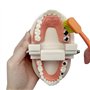 Youya - Modèle de dents de caries dentaires standard - Outil d'étude pour les maladies des adultes - Modèle standard - Pour appr