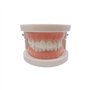 Youya - Modèle de dents de caries dentaires standard - Outil d'étude pour les maladies des adultes - Modèle standard - Pour appr
