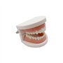 Youya - Modèle de dents de caries dentaires standard - Outil d'étude pour les maladies des adultes - Modèle standard - Pour appr