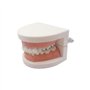 Youya - Modèle de dents de caries dentaires standard - Outil d'étude pour les maladies des adultes - Modèle standard - Pour appr