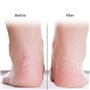Chaussette en Silicone, Respirant Hydratante Chaussettes Antidérapantes en Silicone, Chaussettes Hydratantes Anti-Fentes Pour Le