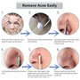 Extracteur d'acné dissolvant de points noirs Acier Inoxydable Outil D’extracteur de Point Noir Professionnel Tire Comédons Acné 