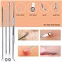 LenEurest Acier Inoxydable Blackhead Remover - Extracteur De Point Noir à Tendance Acnéique Comédons Pour La Peau