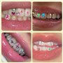Strass Dentaire Kit