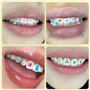 Pour Une DéCoration De Dents Brillante