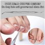 Ongles Incarnés