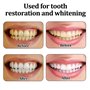 4 Pcs Dentier Provisoire Prothese Dentaire Dentier Fausse Dent Facette Dentaire A Poser Soi Meme Dentier Amovible Haut Et Bas Ap