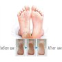 Râpe à Pied Pédicure, Rapeuse Pieds Anti-Callosités, Coupe cors, Rasoir pour Talons, Peaux dures et Mortes en acier inoxydable a