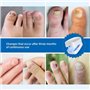 Appareil Traitement Laser Mycose Ongles, Mycose Ongles des Pieds Nettoyage et Réparation Ongles, Traitement Champignons Ongles,7