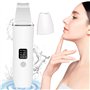 MINSHUXI Nettoyeur de Peau Ultrasonique Épurateur de Peau à Ultrasons Point Noir Extracteur Skin Scrubber avec 4 Modes USB Recha