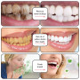 Dentifrice Anti-Taches Blanchissant Les
