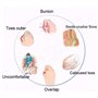Hihey Bunion Splints Dames Grand Toe Hallux Valgus Plateforme De Soutien Sandale Chaussures pour Traitement Sandales Femmes Dame