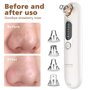 nettoyant pour pores et extracteur d'acné avec 5 niveaux d'aspiration et 4 têtes remplaçables