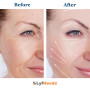 LyfNeeds Rouleau de massage en silicone réutilisable pour le visage, les yeux et le cou - Soin naturel et soin de la peau - Bleu