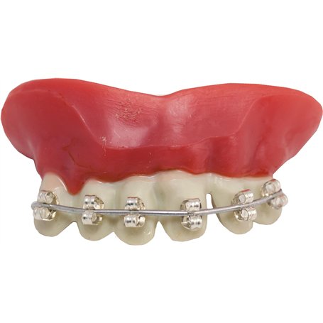 P'TIT CLOWN - Dentier Appareil Dentaire - Parfait pour Déguisement d'halloween