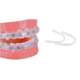 Protège-Lèvres Pour Appareil Dentaire - remplace la Cire Orthodontique - Protège-dents orthodontique pour accolades