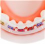 Protège-Lèvres Pour Appareil Dentaire - remplace la Cire Orthodontique - Protège-dents orthodontique pour accolades