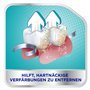 Corega Nettoyant intensif en TABS - Protection complète pour prothèses dentaires amovibles/troisième dents - 1 x 108 pastilles d