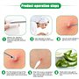Jinlaili 8PCS Tire Comedons, Extracteur Point Noir, Brucelles Blackhead Extractor en Boîte Métallique, Extracteur d'acné Acier I