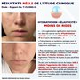 100ml. Bio Crème Hydratante Visage Jour et Nuit á l'Acide Hyaluronique, Retinol et Vitamine C. Anti-âge, Homme & Femme,Raffermis