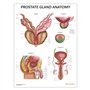 AnatomyStuff Tableau d'anatomie de la prostate 45 x 60 cm