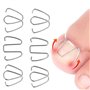 Fil de Correction D'ongle D'orteil, Outil de Correction D'ongle D'orteil, Outil de Soin des Pieds de Traitement de Pédicure de R