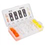 Rivet de retenue, Clips de Garniture de Panneau de Tableau de Bord de Console de Voiture Universelle Rivets Kit de Fixation de B