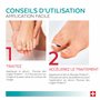 PODERM - MYCOSE ONGLES BOOSTER DE TRAITEMENT pour mycose difficile à traiter | Divise par 2 la durée du Traitement | Soin profes