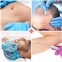 AIESI® Marqueur chirurgical de la peau stylo à pointe fine avec règle HOSPIMARK (Paquet de 10 pièces)