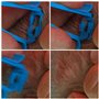 ELANOX Pet Pince à Tique avec Fonction de Levage enlèvement sûr de la Tique sans Glisser