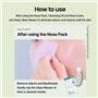 ILSO Deep Clean Master/outil de retrait de points noirs/sûr et fabriqué à partir de silicone/peut être utilisé avec de la crème 