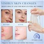 12 pièces Masque de Soin Hydratant Pour la Peau,Masque de Beauté,Masque Visage,Masque soin Quotidien,Masque Hydratant Visage Nou